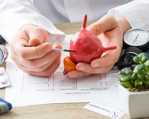 پزشک در حال توضیح روند سیستوسکوپی روی مدلی از مثانه