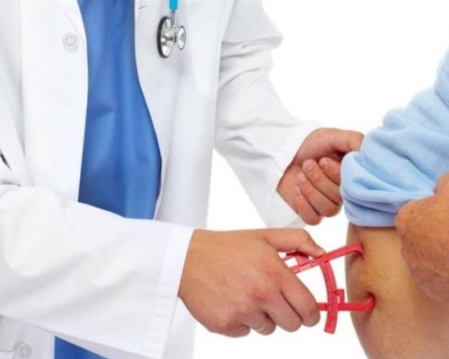 شمار افراد چاق جهان از یک میلیارد نفر گذشت/ افزایش چاقی در سنین 5 تا 19 سال