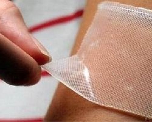 شیوع زخم های مزمن؛ یک اپیدمی بی‌سر و صدا