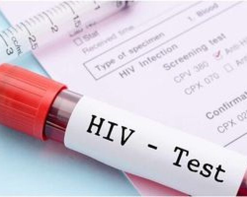 شیوع یک بیماری هم جنس HIV ؛ رفتار پرخطر جنسی دردسرساز شد