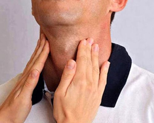 نکاتی در مورد سرطان تیروئید/ اینفوگرافیک