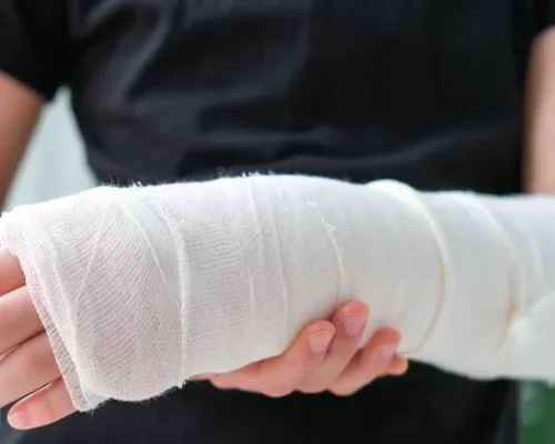 breaking a bone